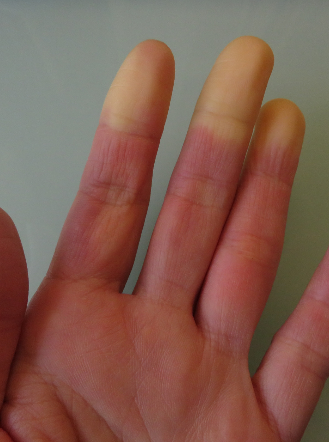 Médico reumatólogo especialista en esclerodermia